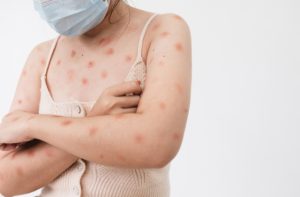 Sumaré confirma primeiro caso de