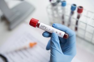 SUS disponibiliza exame de DNA-HPV