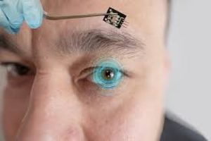 Microchip devolve visão a cegos