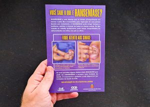 Ações do Janeiro Roxo reforçam orientações sobre Hanseníase em Santa Bárbara