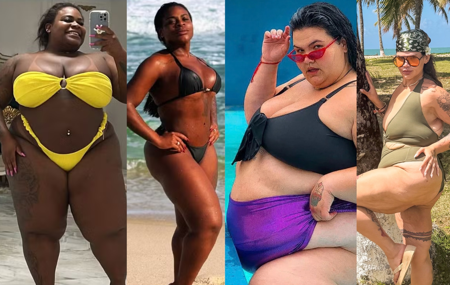 Jojo Todynho e Thais Carla: Como diferenciar gordura de lipedema