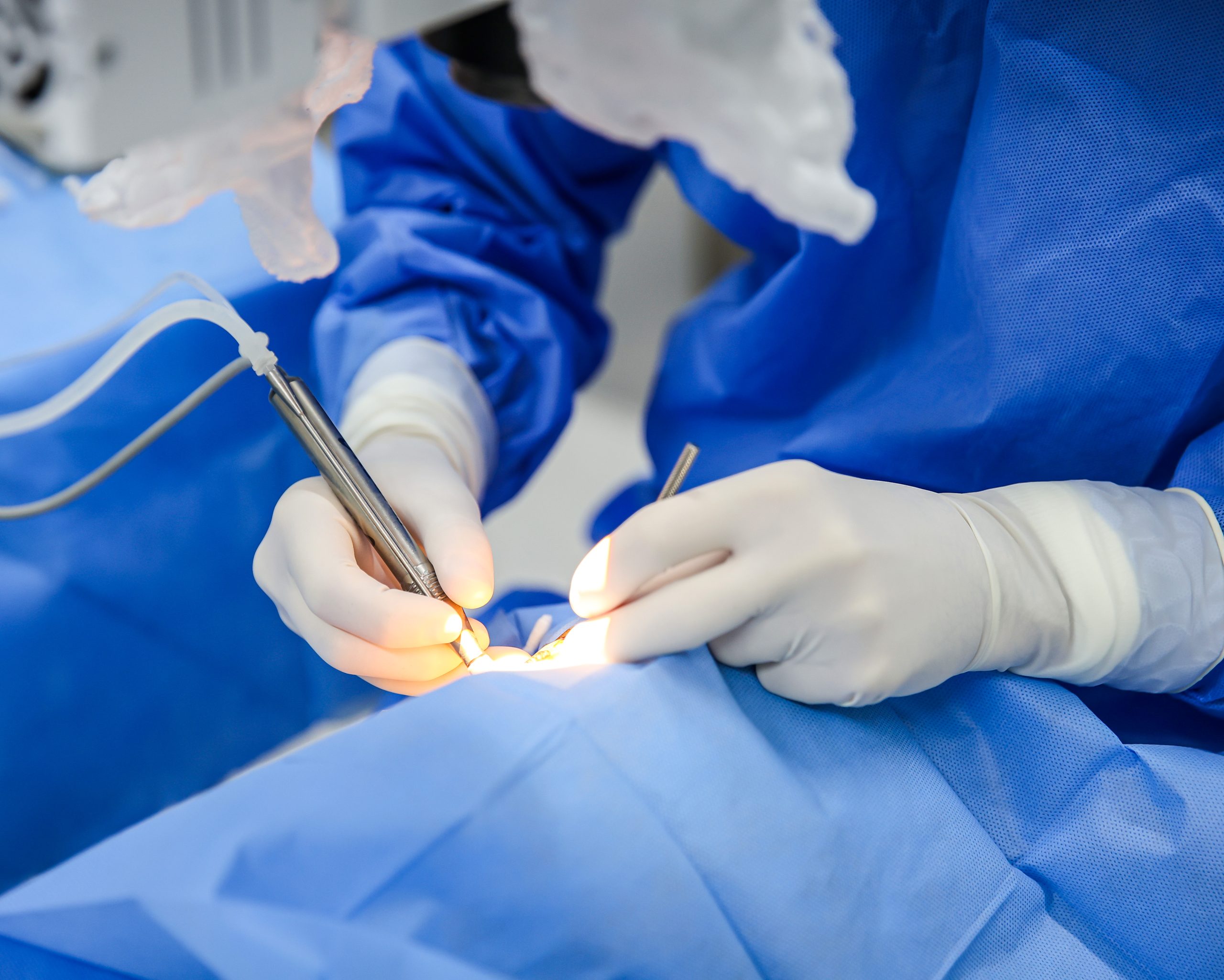 Santa Bárbara atende mais de 200 pacientes em mutirões de cirurgia de catarata